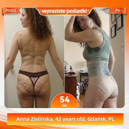 𝐎𝐟𝐢𝐜𝐣𝐚𝐥𝐧𝐲 𝐒𝐤𝐥𝐞𝐩 𝐌𝐚𝐫𝐤𝐢 🇵🇱 | 𝐀𝐊𝐘𝐆𝐎® 𝟐𝟎𝟐𝟔𝐌𝐨𝐫𝐢𝐧𝐠𝐚 x 𝐁𝐞𝐫𝐛𝐞𝐫𝐲𝐧𝐚 x 𝐍𝐀𝐃+ | 𝐒𝐩𝐨𝐝𝐞𝐧𝐤𝐢 𝐌𝐨𝐝𝐞𝐥𝐮𝐣ą𝐜𝐞 𝐢 𝐒𝐩𝐚𝐥𝐚𝐣ą𝐜𝐞 𝐓ł𝐮𝐬𝐳𝐜𝐳 𝟔-𝐰-𝟏 (𝐓𝐞𝐜𝐡𝐧𝐨𝐥𝐨𝐠𝐢𝐚 𝐌𝐢𝐤𝐫𝐨𝐜𝐳ą𝐬𝐭𝐞𝐜𝐳𝐞𝐤)(𝐃𝐥𝐚 𝐤𝐨𝐛𝐢𝐞𝐭 + 𝐃𝐥𝐚 𝐦ęż𝐜𝐳𝐲𝐳𝐧 𝐳 𝐮𝐥𝐞𝐩𝐬𝐳𝐨𝐧ą 𝐟𝐨𝐫𝐦𝐮łą 𝐌ę𝐬𝐤𝐢𝐞𝐣 𝐖𝐢𝐭𝐚𝐥𝐧𝐨ś𝐜𝐢)